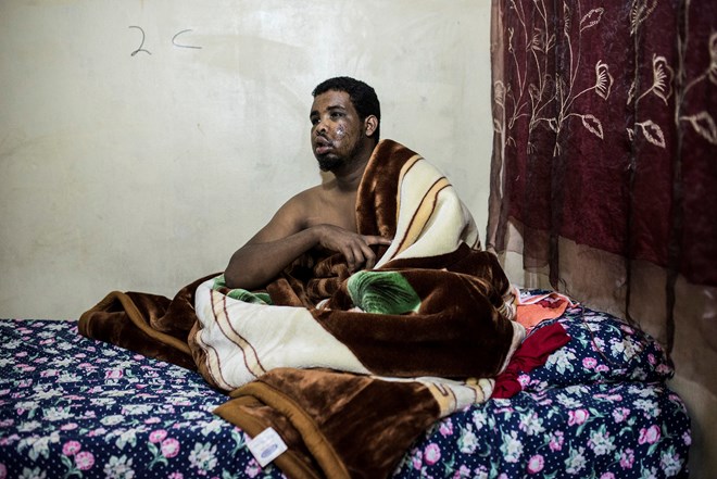 Somali national Ahmed Ibrahim Hashi recovering in a safe house after being severly beaten.