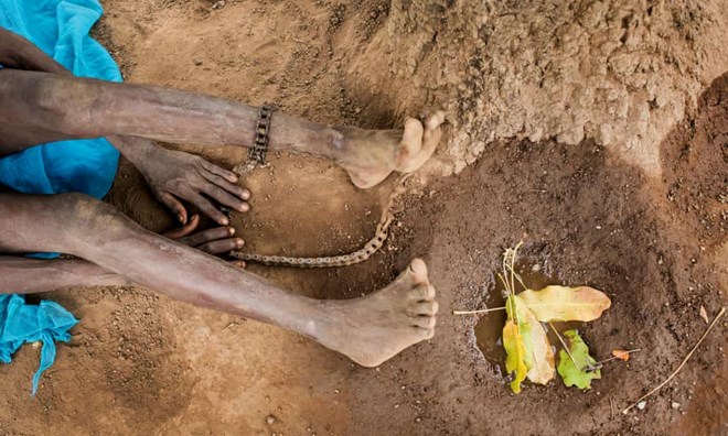 Chains on a woman in norhern Ghana who has schizophrenia: shackling is typically practised by families who believe that mental health conditions are the result of evil spirits or an individual having sinned. Photograph: Robin Hammond/Witness Change/The Guardian