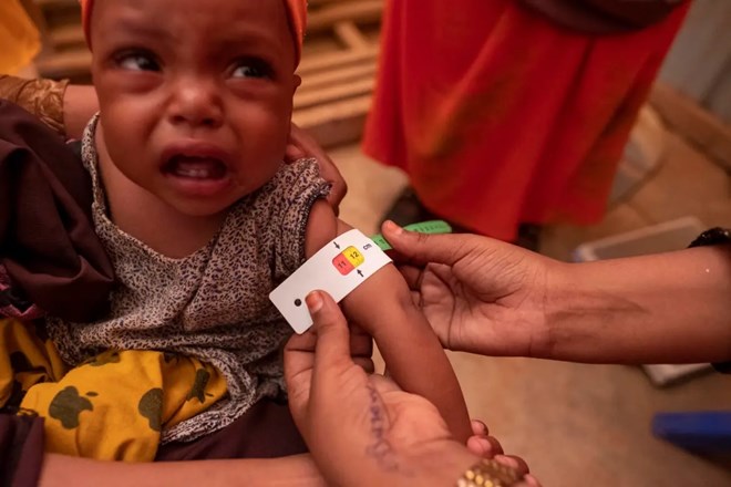 A child is given a health check at the Kabasa IDP Center run by Cedar and supported by ECHO/UNICEF in Dollow, Somalia. [Rich/UNICEF]