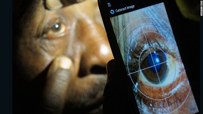A smartphone app developed by Peek Vision (Portable Eye Examination Kit) has been used in Kenya, Botswana and India to test patients who would otherwise find getting proper eye care difficult.