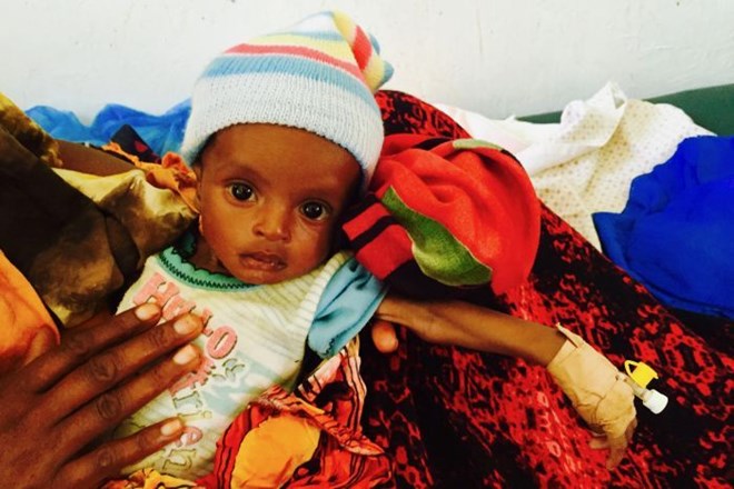 Photo: Three-month old Mohamed in Burao General Hospital. (ABC News: Sally Sara)