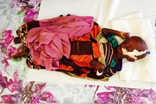 Photo: A child suffering with malnutrition. (ABC News: Sally Sara)