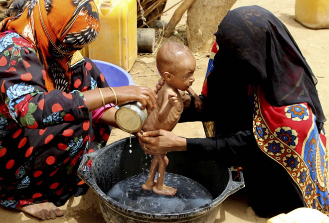 A severely malnourished infant is bathed in a bucket Aug. 25 in Yemen's Hajjah province. About 2.9 million women and children are acutely malnourished in that country. (Hammadi Issa/AP)